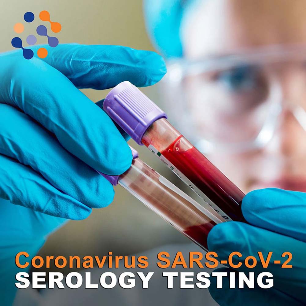 COVID-19 Testing Available